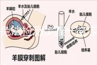 酶免法檢測步驟一覽 艾滋病