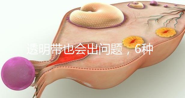 透明帶也會(huì)出問題，6種異常類型形成原因不同