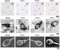 那個國家做試管嬰兒不要結(jié)婚證