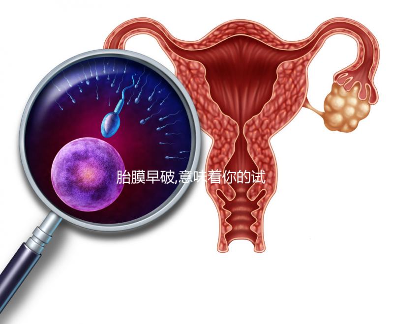 胎膜早破,意味著你的試管嬰兒媽媽夢(mèng)也破裂了?!