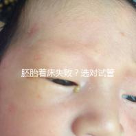 胚胎著床失敗？選對(duì)試管嬰兒醫(yī)生很重要