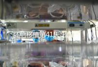 胚胎移植第41天出血是流產(chǎn)信號(hào)?這幾種出血沒(méi)必要擔(dān)心