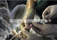 腎功能檢查流程并不復(fù)雜，掌握這幾個步驟方可一步到位