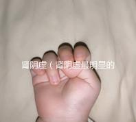 腎陰虛(腎陰虛最明顯的一點(diǎn))