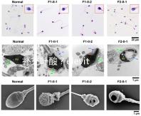 補充葉酸?elevit愛樂維那你不得不了解