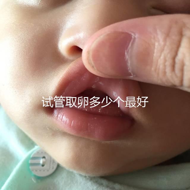 試管取卵多少個最好