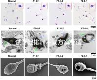 試管促排卵不同方案都適合哪些人？如何監(jiān)測(cè)排卵？