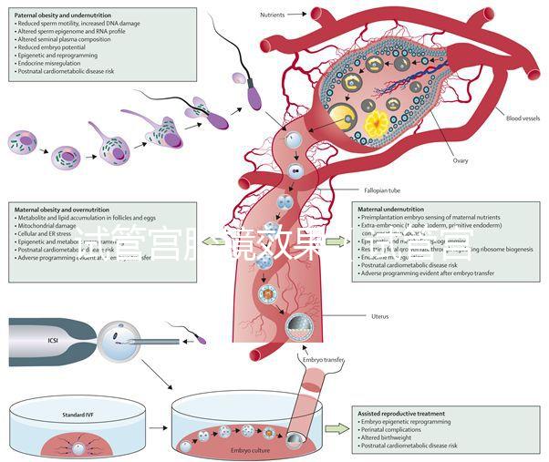 試管宮腔鏡效果(試管宮腔鏡效果怎么樣)