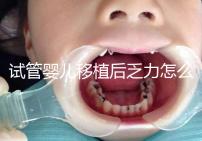 試管嬰兒移植后乏力怎么回事？匡延平主任告訴你答案