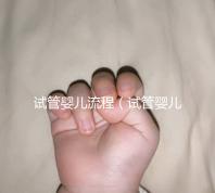試管嬰兒流程（試管嬰兒流程八個(gè)詳細(xì)步驟）