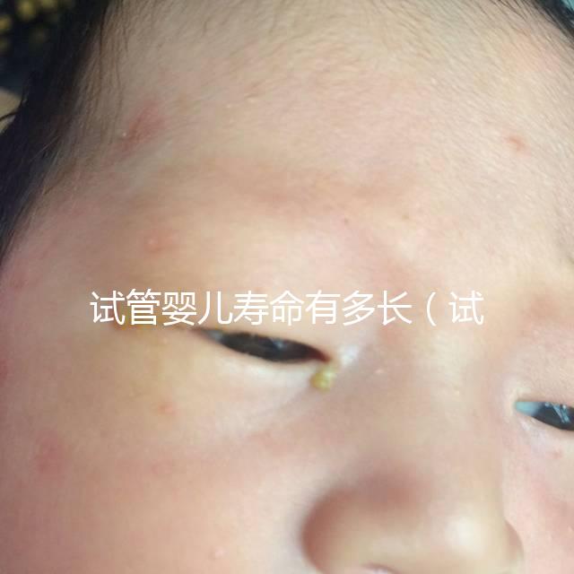 試管嬰兒壽命有多長（試管嬰兒壽命有多長時(shí)間）