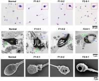試管嬰兒費(fèi)用是多少錢（試管嬰兒費(fèi)用是多少錢一次）
