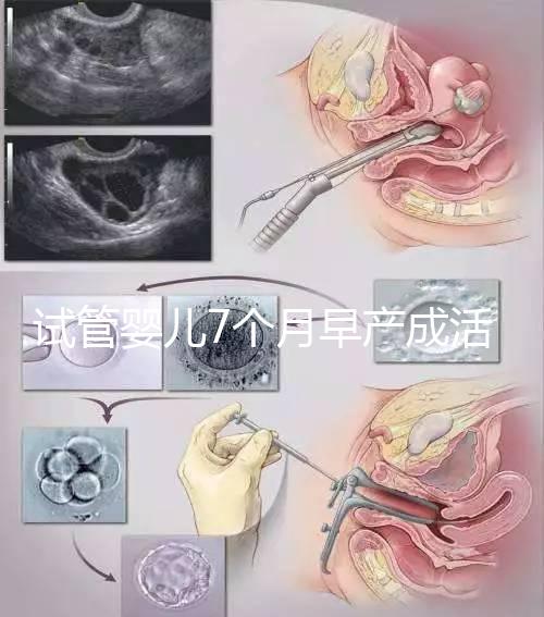 試管嬰兒7個月早產成活率高達80%！能不能要看身體狀況