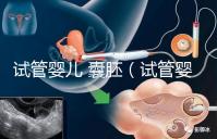 試管嬰兒 囊胚(試管嬰兒囊胚質量等級)