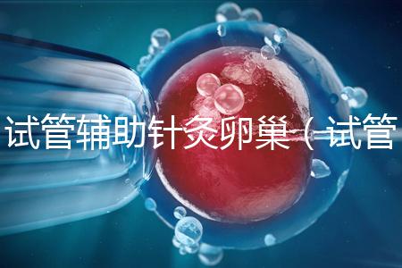 試管輔助針灸卵巢(試管輔助針灸卵巢有用嗎)