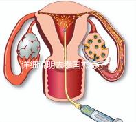 詳細(xì)說明去泰國杰特寧生殖中心做第三代試管技術(shù)的五大優(yōu)勢(shì),幫助你克服生育問題,快速隱藏!