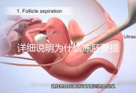 詳細說明為什么凍胚要提前一兩天解凍，有沒有影響一目了然