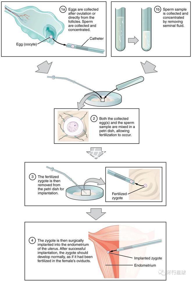 貴陽未婚子女戶口如何向婦女介紹,附2024年結(jié)算流程