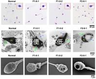 預(yù)約方便,成本低!2024年西安新城、臨潼、雁塔四維彩超指南