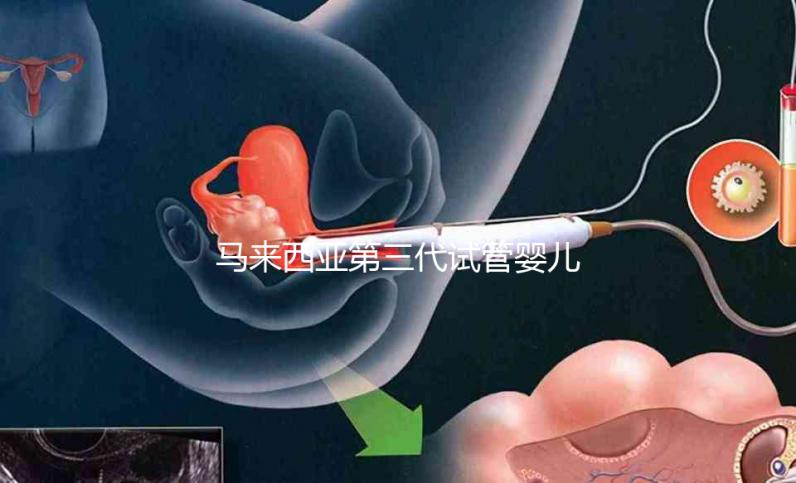 馬來西亞第三代試管嬰兒優(yōu)勢有哪些?NGS篩查準(zhǔn)確率可達(dá)99%