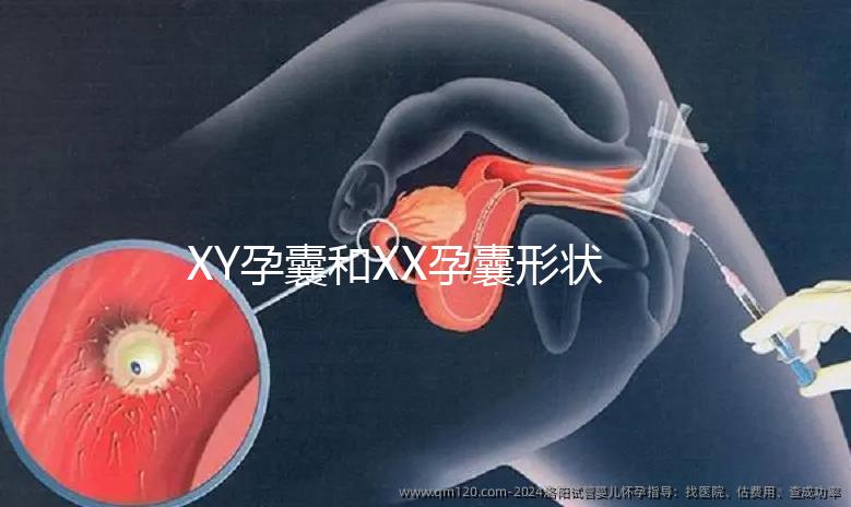 XY孕囊和XX孕囊形狀各有差異，橢圓形可能是懷女哦！