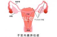 1分鐘解說讓你讀懂,排卵試紙白板一根線等各個反應