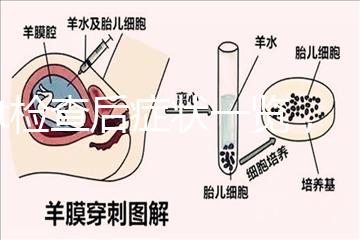 tct檢查后癥狀一覽，專家提醒做好處理措施是關鍵